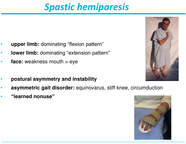 CVA-spastic-hemiparesis